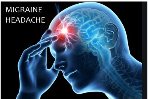 Migraine Cure